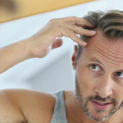 8 Tips to Combat Hair Loss in Men