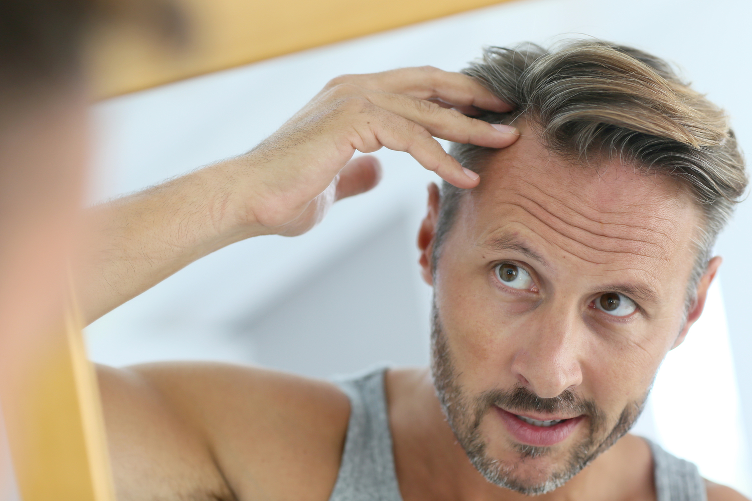8 Tips to Combat Hair Loss in Men