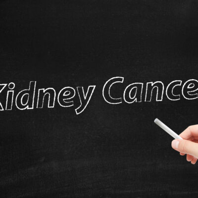 Kidney Cancer – Stages and Treatments