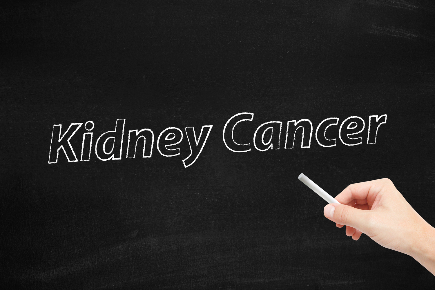 Kidney Cancer – Stages and Treatments
