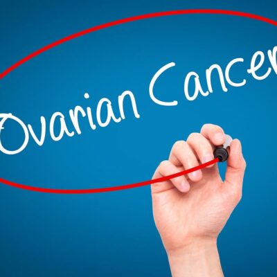 Ovarian Cancer Treatments