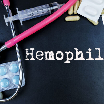 Symptoms and Treatment Options for Hemophilia