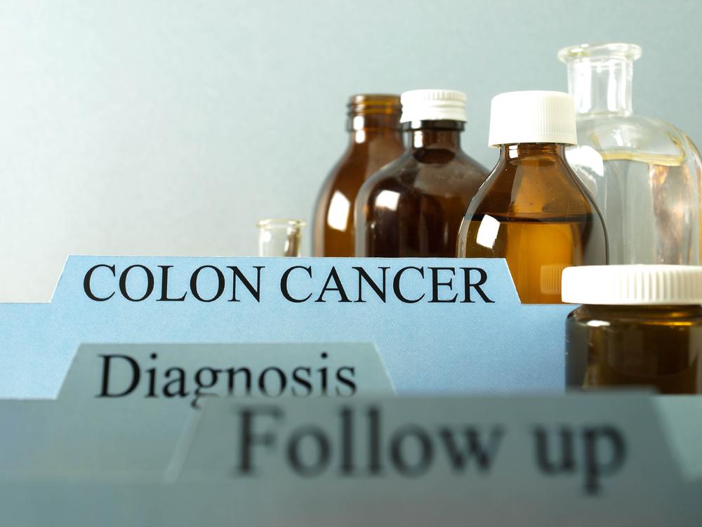 The Stages and Treatments for Colon Cancer